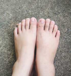 a pair of healthy feet that are widest at the toes