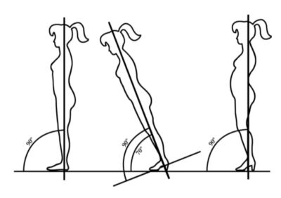 a diagram showing how wearing high heels would cause the body to fall if it did not compensate by changing alignment