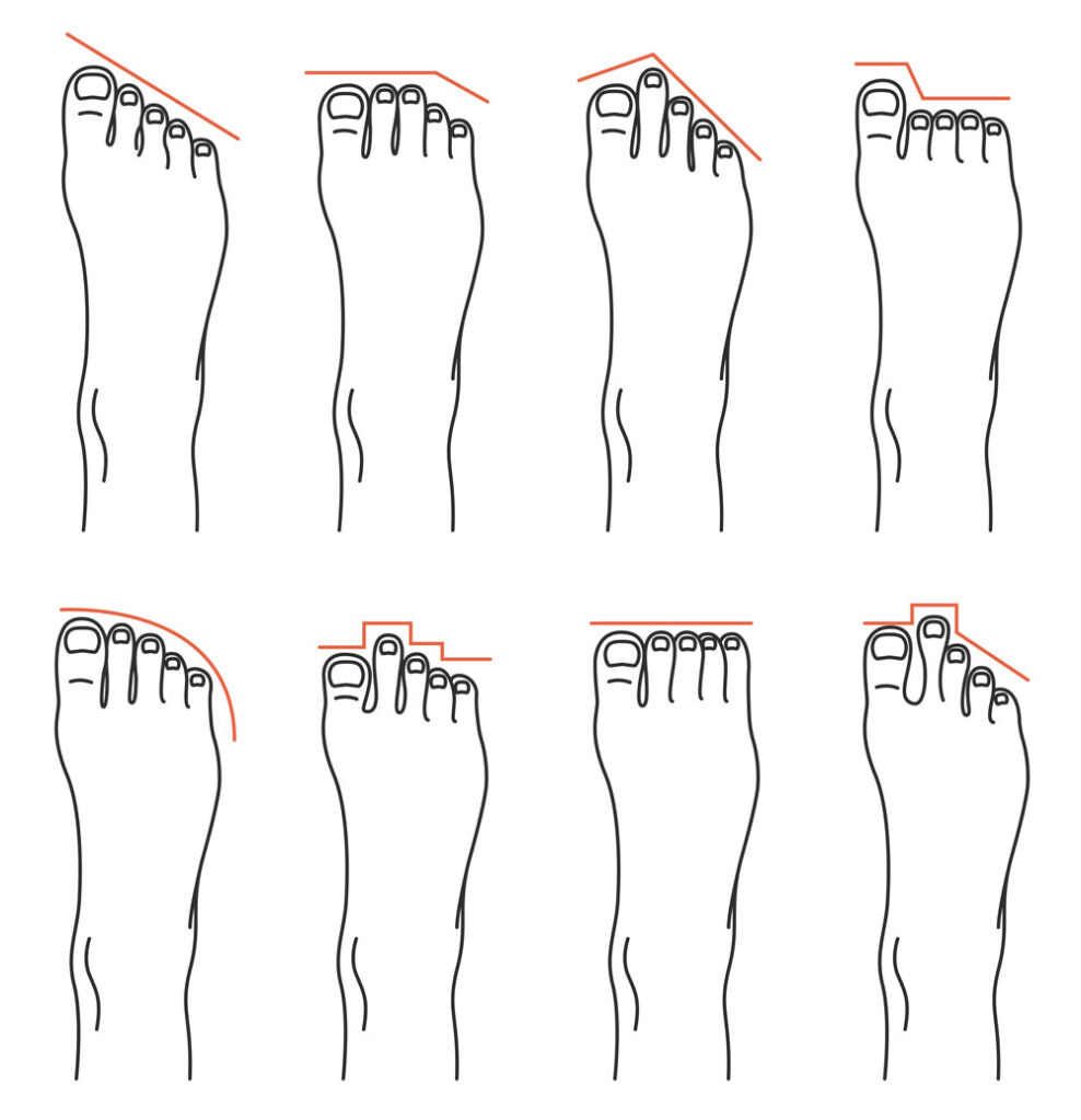 an illustration showing variations in foot shape